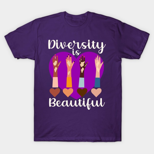 Vitiligo Awareness Diversity is Beautiful Girls Womens T-Shirt by Mind Your Tee